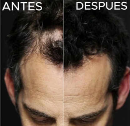 TOPPIK-FIBRAS CAPILARES- ¡Disimula la caída de cabello!