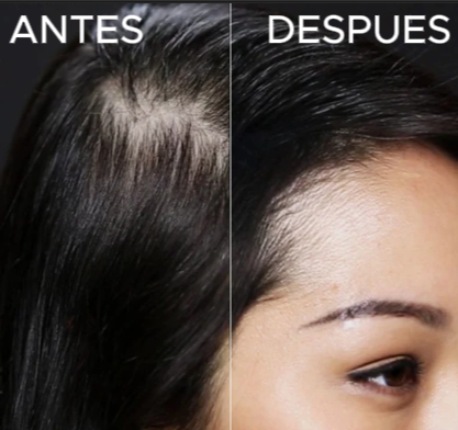 TOPPIK-FIBRAS CAPILARES- ¡Disimula la caída de cabello!