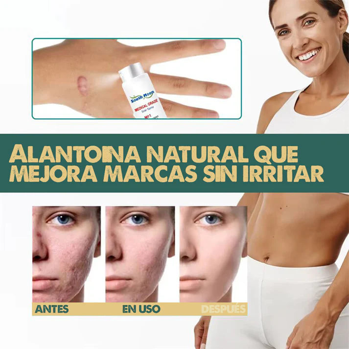 🎁PROMO 2X1🎁 South Moon™ - Spray Elimina Cicatrices En Poco Tiempo